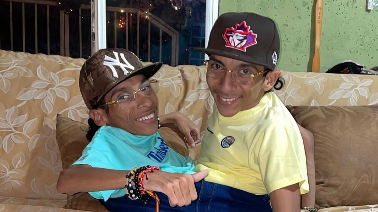 Conjoined twin influencers die aged 27 after one suffers heart attack